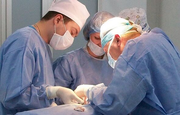 rawatan operasi vena varikos