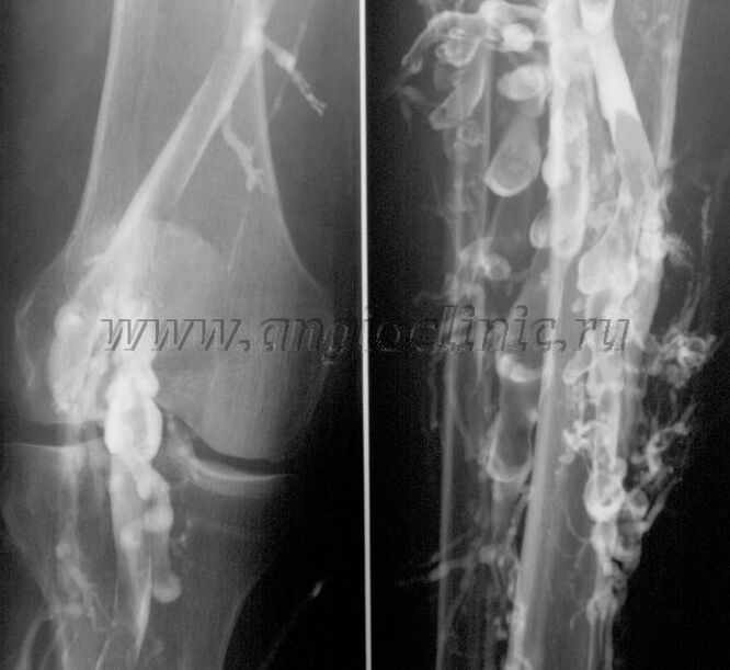 Pemeriksaan ultrabunyi